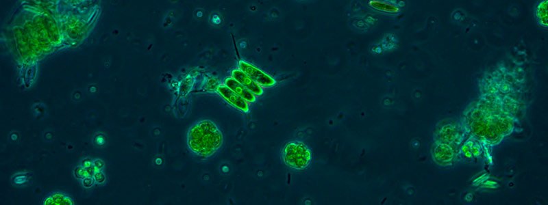 Microalgas vistas al microscopio.